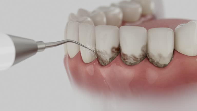 Trusted Teeth Cleaning And Checkup service in Bakersfield, CA - Dentist Open Now